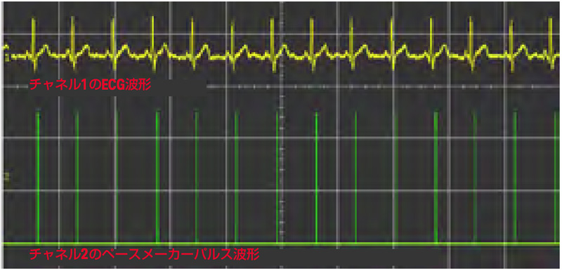 1つに結合された2つの波形